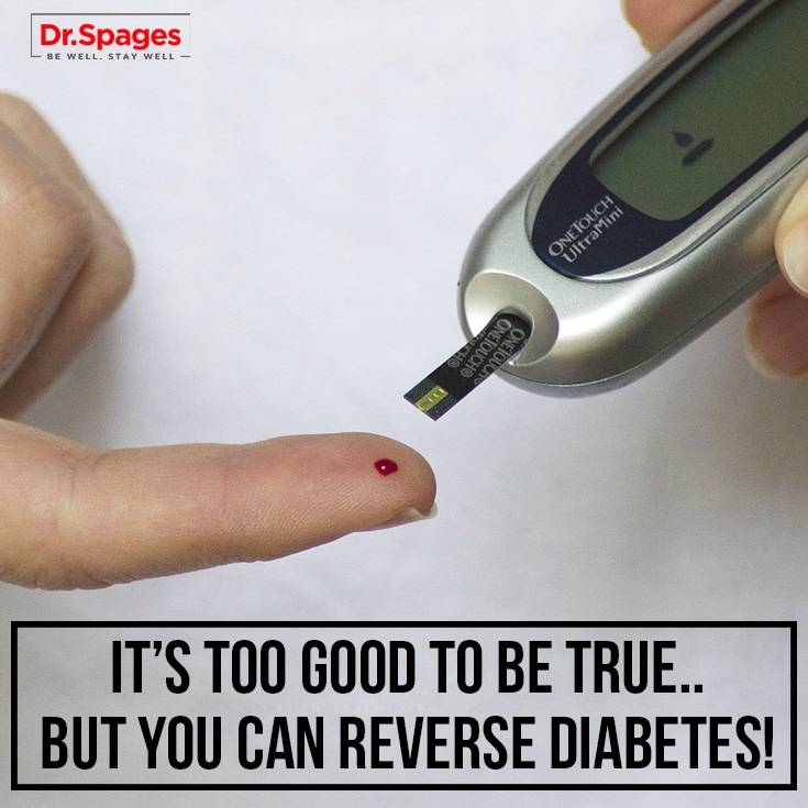 How You can Reverse Diabetes | Healthy Eating | Exercise | Dr. Spages